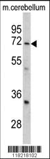 Anti-GARP Rabbit Polyclonal Antibody