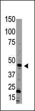 Anti-BMP15 Rabbit Polyclonal Antibody (APC (Allophycocyanin))