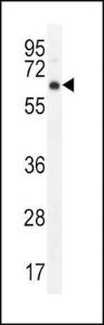 Anti-AKT1 Rabbit Polyclonal Antibody