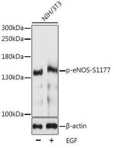 Western blot analysis of extracts of NIH/3T3 cells, using Anti-eNOS (phospho Ser1177) Antibody (A10995) at 1:1,000 dilution