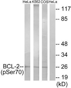 Western blot analysis o