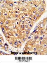 Anti-GARP Rabbit Polyclonal Antibody