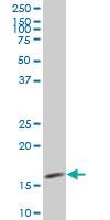 Anti-MED21 Mouse Monoclonal Antibody [clone: 6B6]