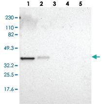 Anti-ARPC1A Rabbit Polyclonal Antibody