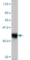 Anti-SPRYD7 Mouse Monoclonal Antibody [clone: 2G4]