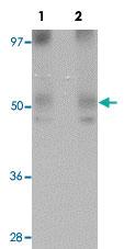 Anti-MINA Rabbit Polyclonal Antibody