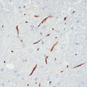 Immunohistochemistry analysis of paraffin-embedded mouse spinal cord using Anti-eNOS (phospho Ser1177) Antibody (A10995) at a dilution of 1:200 (40x lens). Perform microwave antigen retrieval with 10 mM Tris/EDTA buffer pH 9.0 before commencing with IHC staining protocol.