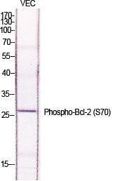 Western blot analysis of various cells using Anti-BCL-2 (phospho Ser70) Antibody