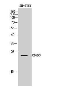 Anti-CDKN3 Rabbit Polyclonal Antibody