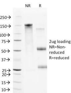 SDS-PAGE analysis of Anti-VCAM1 Antibody [B-K9] under non-reduced and reduced conditions; showing intact IgG and intact heavy and light chains, respectively. SDS-PAGE analysis confirms the integrity and purity of the antibody.