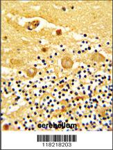 Anti-GARP Rabbit Polyclonal Antibody