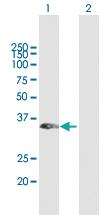 Anti-RASSF1 Mouse Polyclonal Antibody