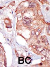 Anti-TNK1 Rabbit Polyclonal Antibody