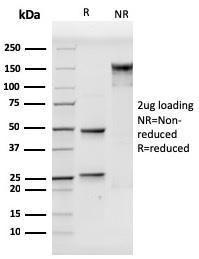 SDS-PAGE analysis of Anti-VCAM1 Antibody [VCAM1/3499] under non-reduced and reduced conditions; showing intact IgG and intact heavy and light chains, respectively. SDS-PAGE analysis confirms the integrity and purity of the antibody.