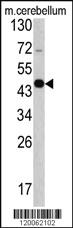 Anti-GAS7 Rabbit Polyclonal Antibody