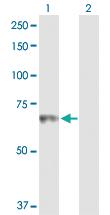 Anti-HLX Rabbit Polyclonal Antibody