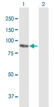 Anti-PKP3 Mouse Polyclonal Antibody