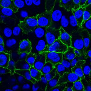 Surface labeling of HeLa cells with CF488A-conjugated cholera toxin B subunit (green), followed by fixation in paraformaldehyde and permeabilization with 0.1% Triton X-100. Nuclei are stained with DAPI (blue)