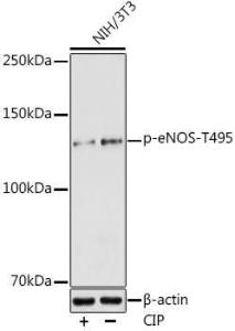 Western blot analysis of extracts of NIH/3T3 cells, using Anti-eNOS (phospho Thr495) Antibody (A10996) at 1:1,000 dilution