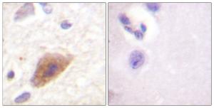 Immunohistochemical analysis of paraffin-embedded human brain tissue using Anti-Tyrosine Hydroxylase Antibody. The right hand panel represents a negative control, where the antibody was pre-incubated with the immunising peptide