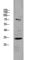 Anti-CDKN3 Rabbit Polyclonal Antibody