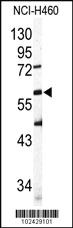 Anti-SIGLEC6 Rabbit Polyclonal Antibody