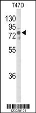 Anti-TNK1 Rabbit Polyclonal Antibody