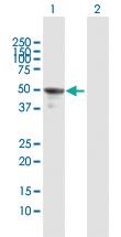 Anti-DCTN2 Rabbit Polyclonal Antibody