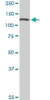 Anti-TBCD Mouse Polyclonal Antibody