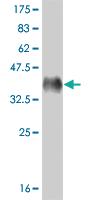 Anti-MED17 Mouse Monoclonal Antibody [clone: 1B5]