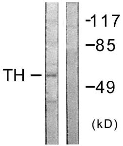 Western blot analysis of lysates from COLO205 cells using Anti-Tyrosine Hydroxylase Antibody. The right hand lane represents a negative control, where the antibody is blocked by the immunising peptide