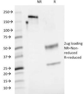 SDS-PAGE analysis of Anti-CD48 Antibody [5-4.8] under non-reduced and reduced conditions; showing intact IgG and intact heavy and light chains, respectively. SDS-PAGE analysis confirms the integrity and purity of the antibody