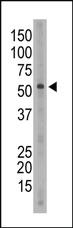 Anti-SIGLEC6 Rabbit Polyclonal Antibody