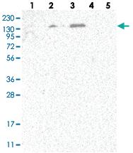 Anti-SPOCD1 Rabbit Polyclonal Antibody