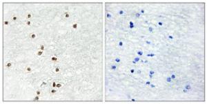 Immunohistochemical analysis of paraffin-embedded human brain tissue using Anti-ZIC1 + ZIC2 + ZIC3 Antibody. The right hand panel represents a negative control, where the antibody was pre-incubated with the immunising peptide.