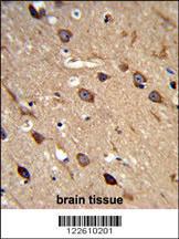 Anti-ASIC1 Rabbit Polyclonal Antibody (FITC (Fluorescein Isothiocyanate))