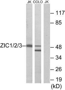 Western blot analysis of lysates from Jurkat and COLO cells using Anti-ZIC1 + ZIC2 + ZIC3 Antibody. The right hand lane represents a negative control, where the antibody is blocked by the immunising peptide.