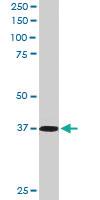 Anti-PDLIM4 Goat Polyclonal Antibody