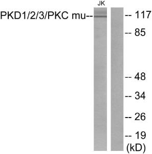 Western blot analysis of lysates from Jurkat cells using Anti-PKD1 + PKD2 + PKD3 Antibody. The right hand lane represents a negative control, where the antibody is blocked by the immunising peptide