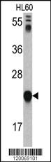 Anti-GLO1 Rabbit Polyclonal Antibody