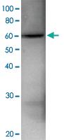 Anti-RPN3 Rabbit Polyclonal Antibody