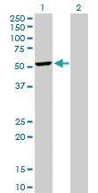 Anti-DCTN2 Rabbit Polyclonal Antibody