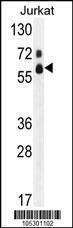 Anti-FASTK Rabbit Polyclonal Antibody (PE (Phycoerythrin))