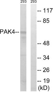 Western blot analysis of lysates from K562 cells, treated with PMA 125ng/ml 30' using Anti-PAK4 + PAK5 + PAK6 Antibody. The right hand lane represents a negative control, where the antibody is blocked by the immunising peptide