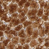 Anti-SCAP Rabbit Polyclonal Antibody