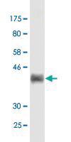 Anti-FBLN1 Mouse Monoclonal Antibody [clone: 2G9]