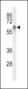 Anti-ITPKC Rabbit Polyclonal Antibody (HRP (Horseradish Peroxidase))