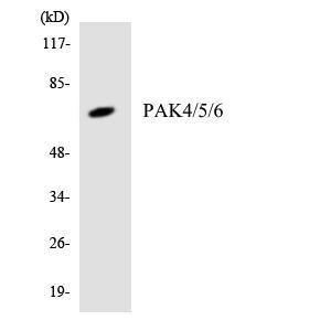 Western blot analysis of the lysates from Jurkat cells using Anti-PAK4 + PAK5 + PAK6 Antibody