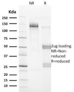 SDS-PAGE analysis of Anti-Vinculin Antibody [VCL/2572] under non-reduced and reduced conditions; showing intact IgG and intact heavy and light chains, respectively. SDS-PAGE analysis confirms the integrity and purity of the Antibody