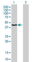 Anti-HMBS Mouse Monoclonal Antibody [clone: 3E8]